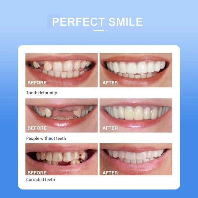 Snap On Smile Braces Teeth Kit For Men & Women | Buy 1 Get 1 Free
