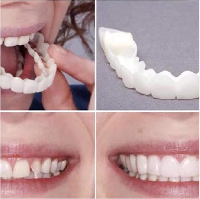 Snap On Smile Braces Teeth Kit For Men & Women | Buy 1 Get 1 Free