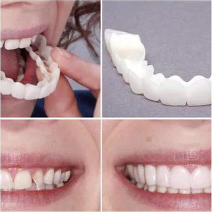 Snap On Smile Braces Teeth Kit For Men & Women | Buy 1 Get 1 Free
