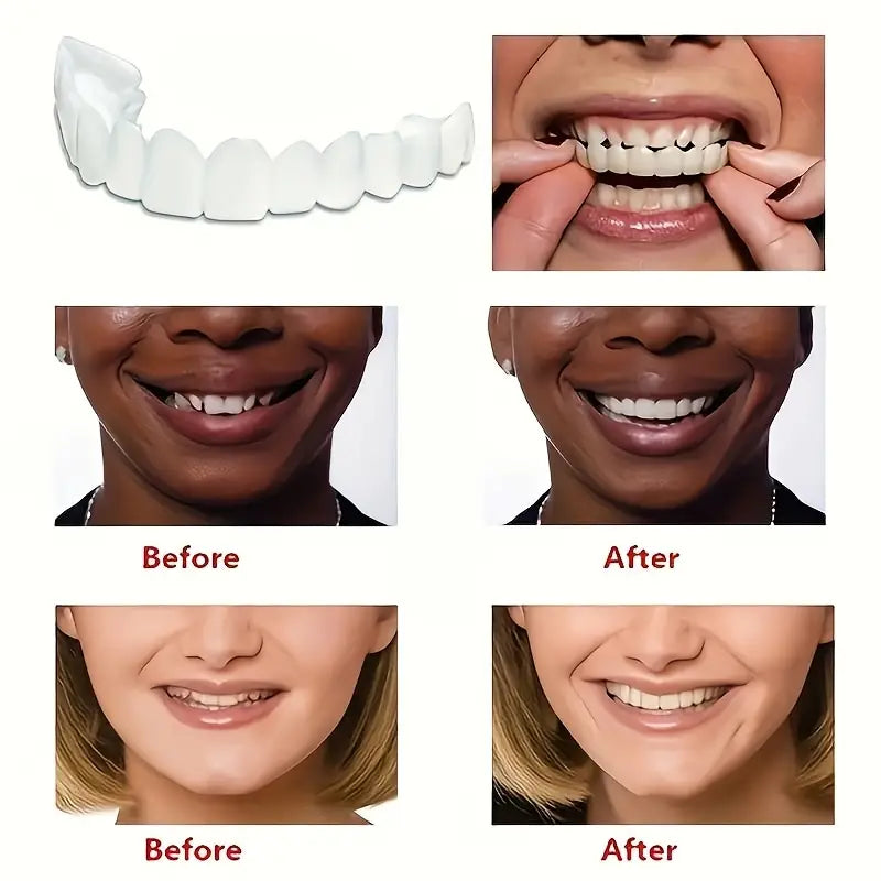 Snap On Smile Braces Teeth Kit For Men & Women | Buy 1 Get 1 Free